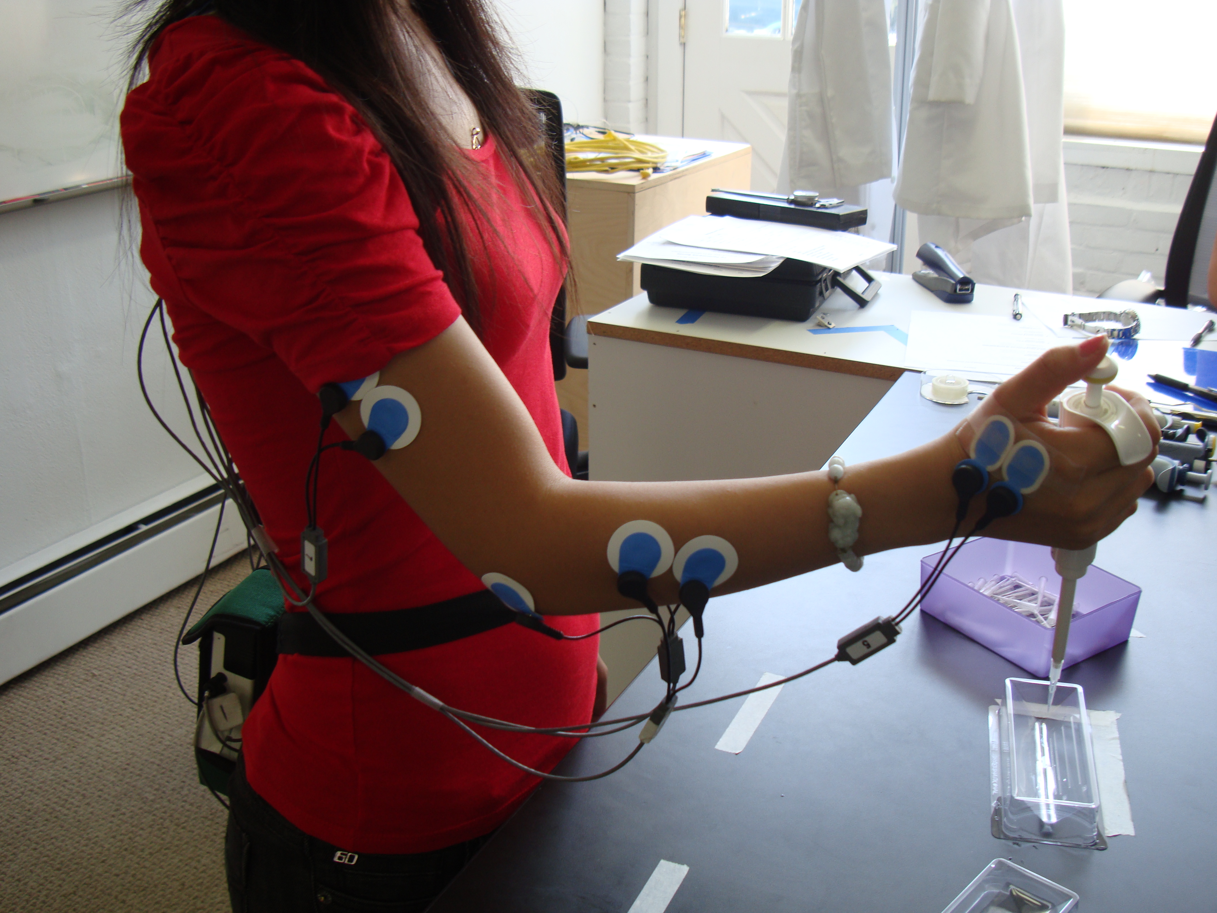 electromyography-emg-purpose-procedure-and-results